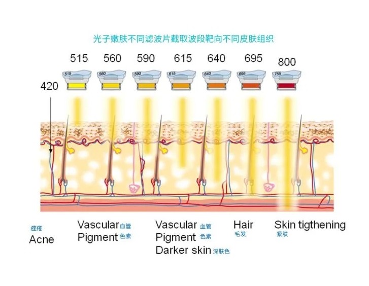 五大光子嫩膚技術(shù)（IPL、DPL、OPT、APT、BBL）及濾光片區(qū)別